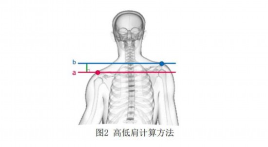 中國(guó)青少年身體(tǐ)姿态健康亟待重视 如何合理(lǐ)干预？